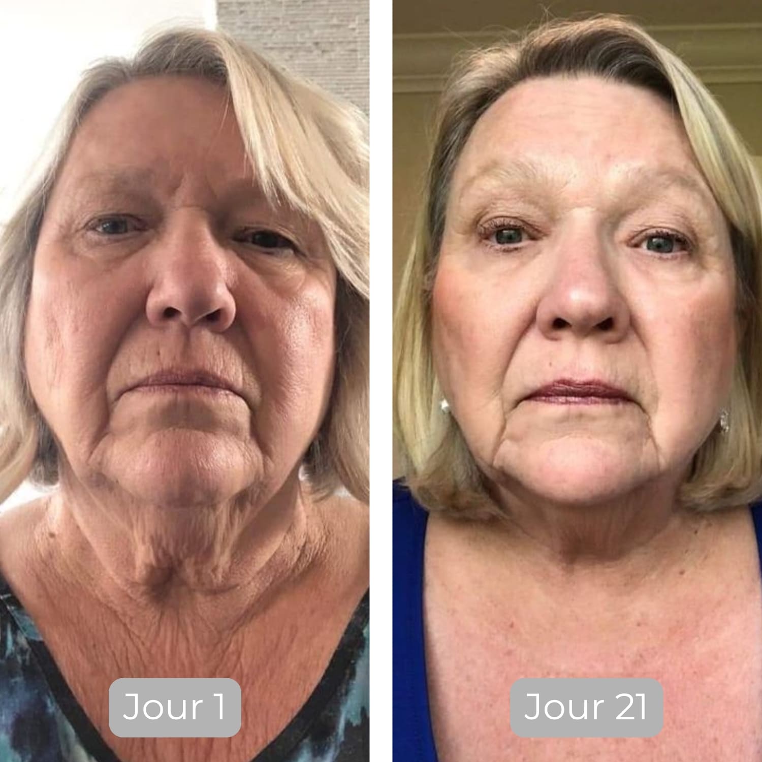 Luminate Face Serum Vitamine C